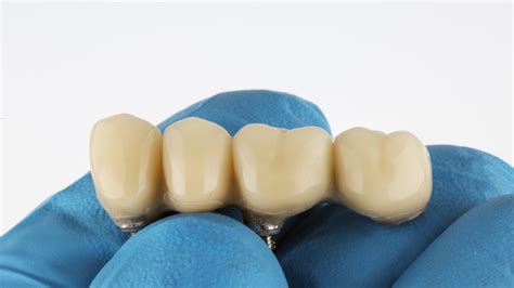  Zirconia: révolutionnant l’industrie dentaire et les composants mécaniques haute performance!