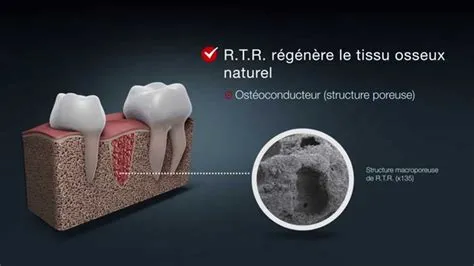 Hydroxyapatite: Le Biomatériau Minéral pour une Croissance Osseuse Exceptionnelle !